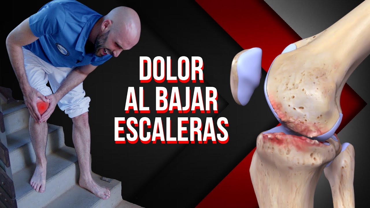 dolor de rodilla al bajar escaleras