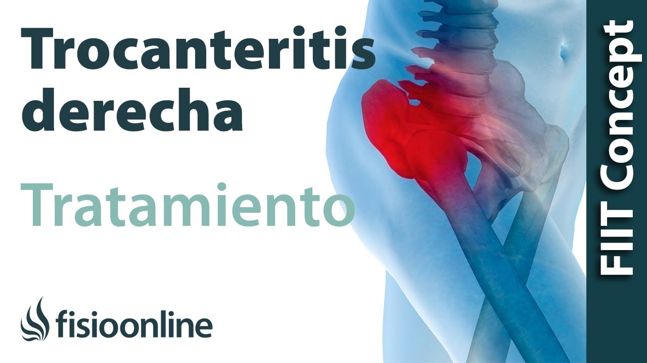 dolor en la cabeza del femur derecho