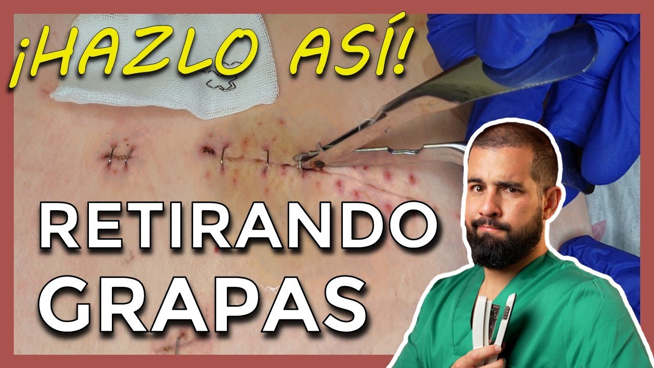 duele quitar las grapas de una herida