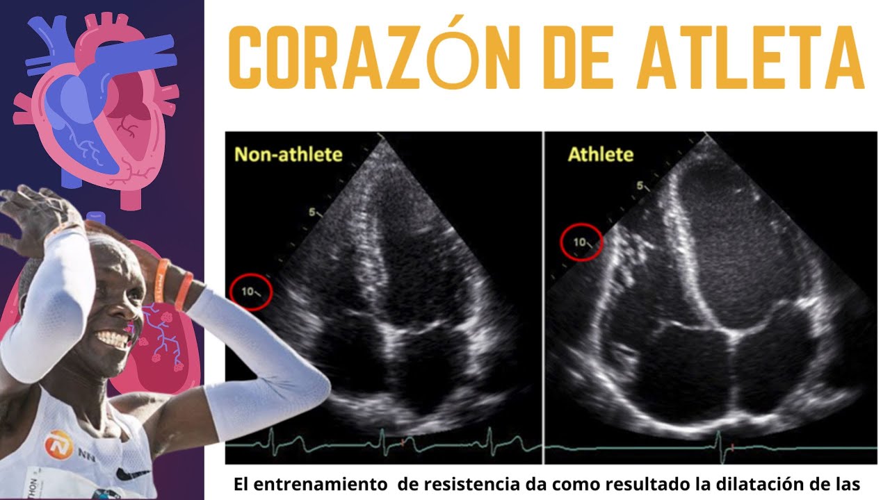 el entrenamiento de resistencia aumenta el tamaño del corazon