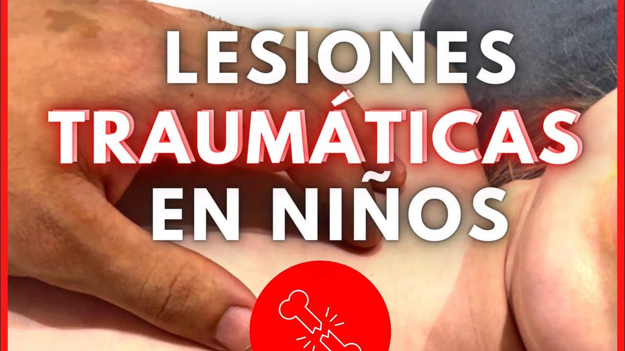 fractura de clavicula en niños tratamiento