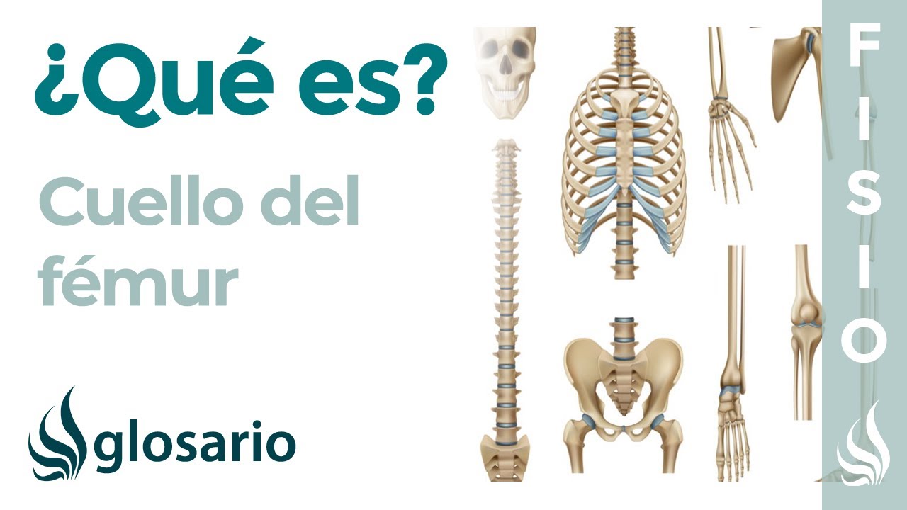 fractura de cuello de femur tratamiento