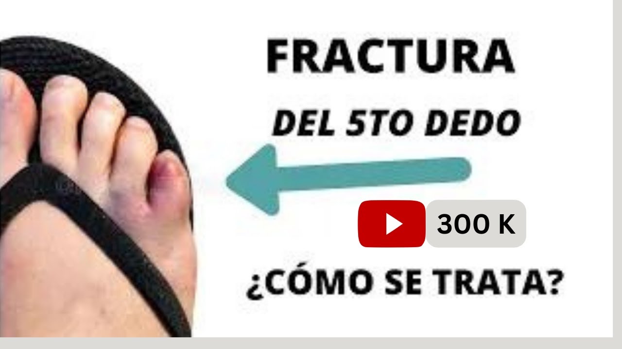 fractura del dedo meñique del pie derecho