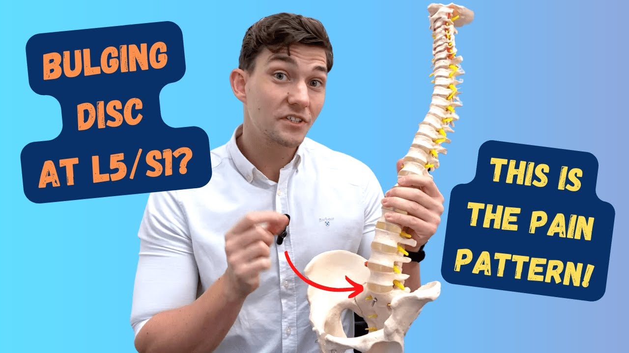 hernia discal paracentral izquierda l5 s1