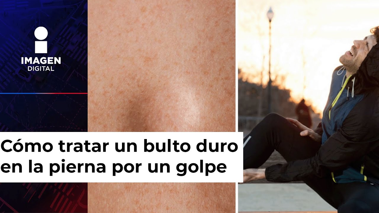 hinchazon por golpe en la pierna