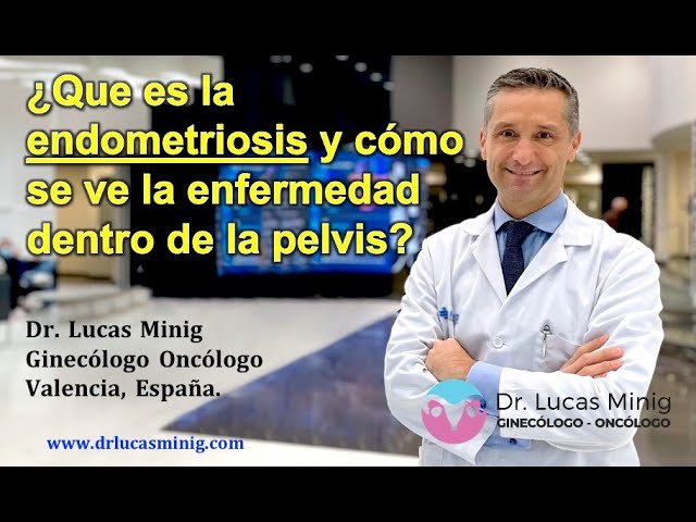 hiperplasia endometrial y dolor de espalda