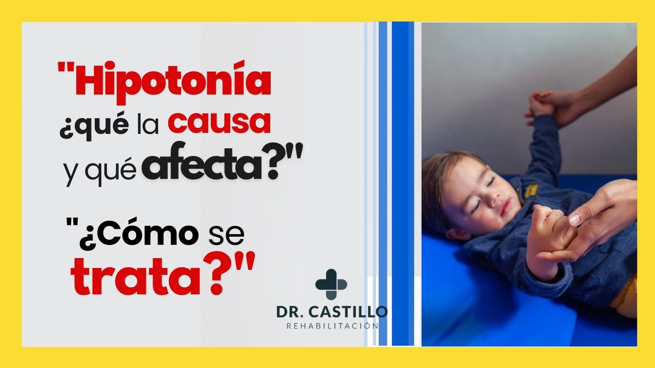 niños con hipotonia y retraso psicomotor