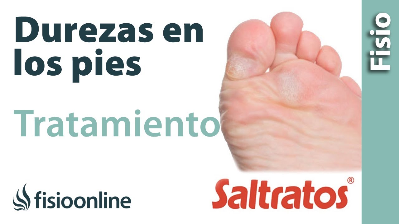 porque duelen las durezas de los pies