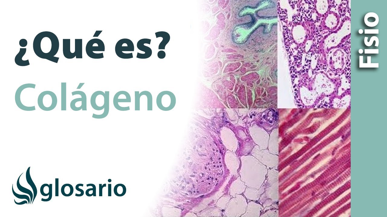 porque los tendones tienen colageno y no elastina