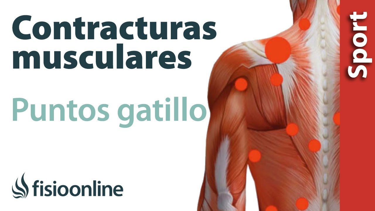 puntos de dolor en la espalda