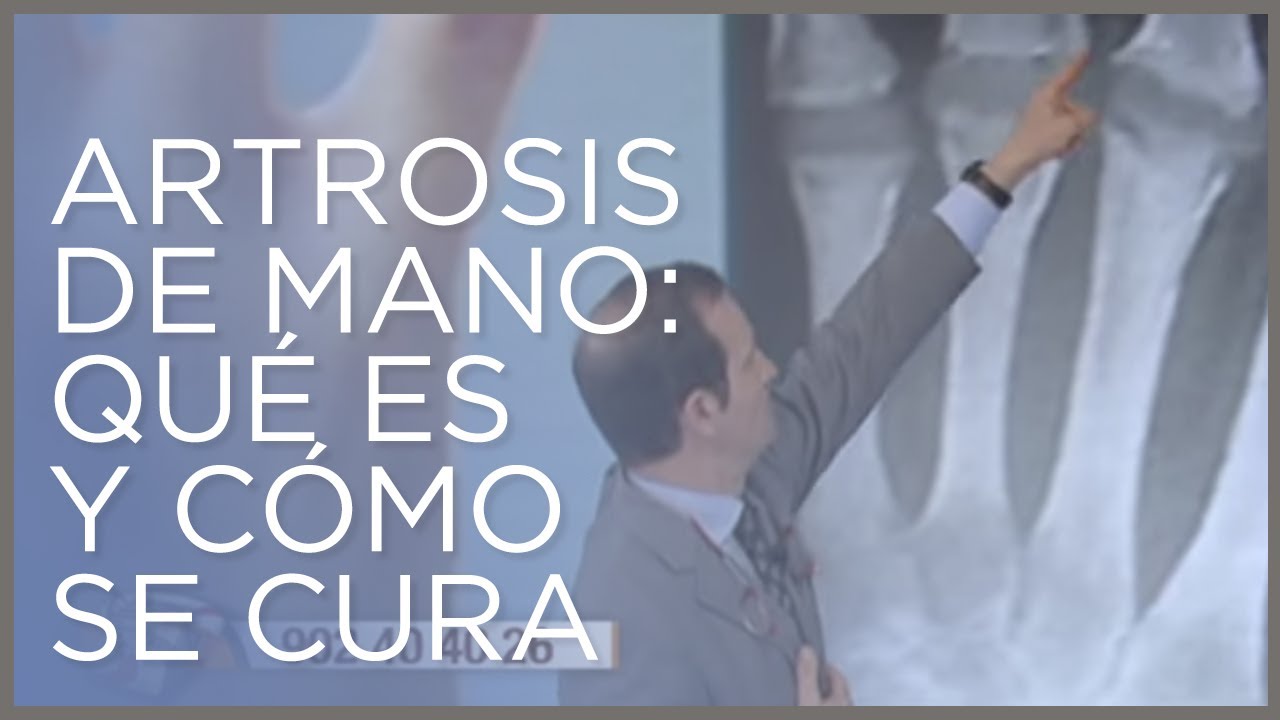 que es la artrosis en las manos