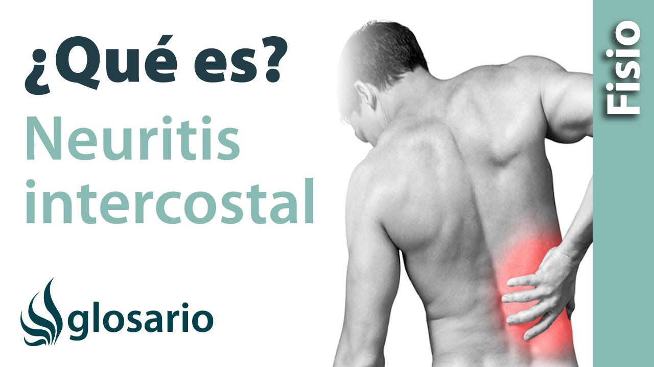 que es una neuritis intercostal izquierda