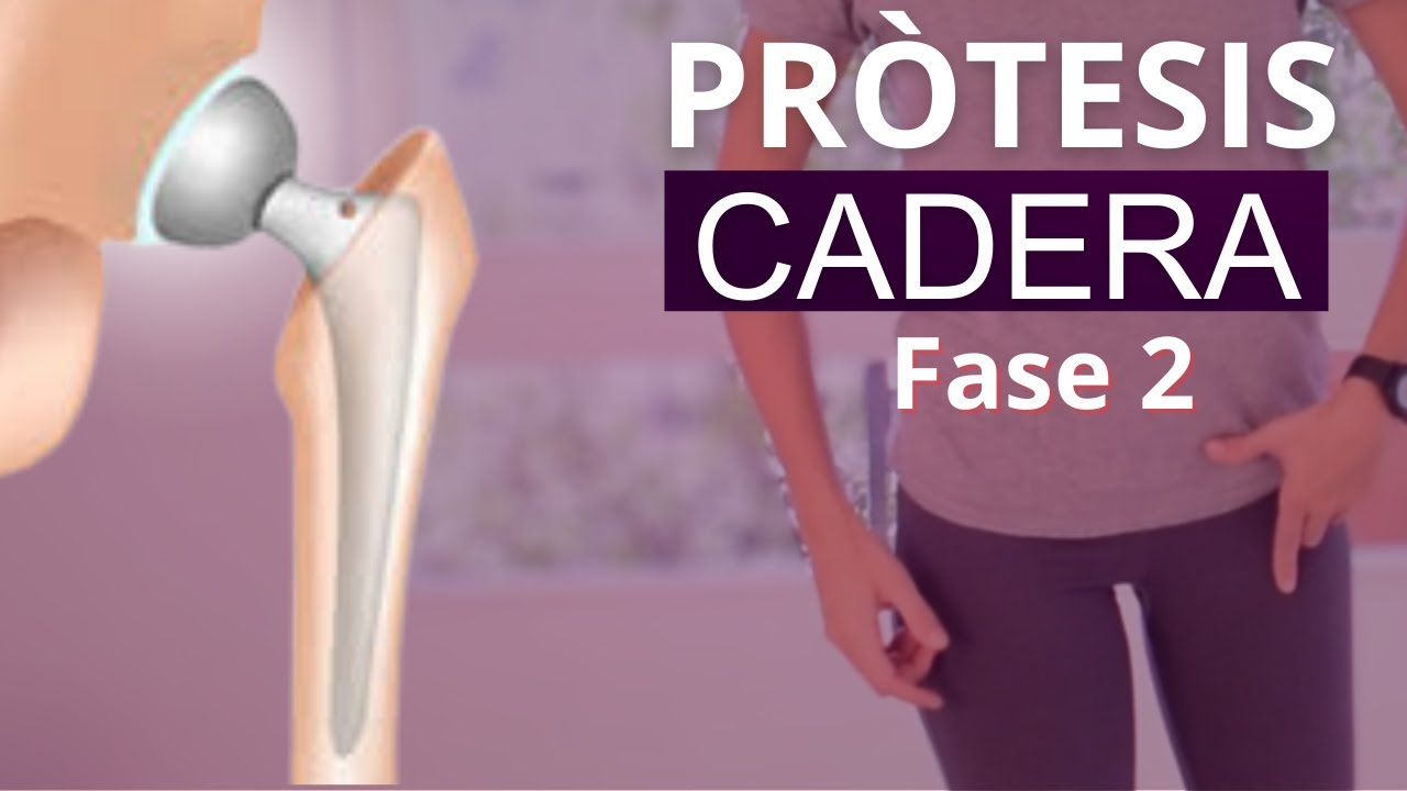 rehabilitacion protesis de cadera fase 2