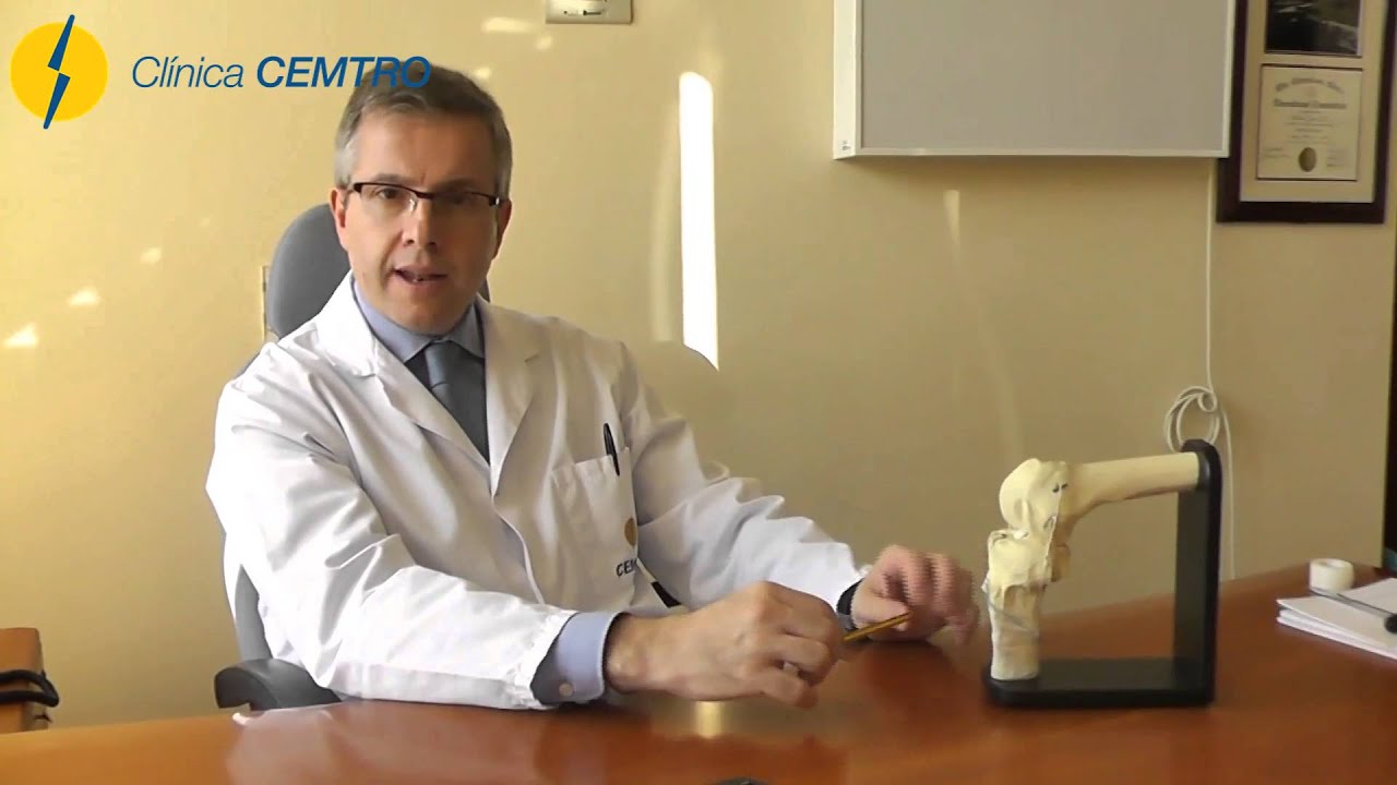 tiempo de baja por fractura meseta tibial