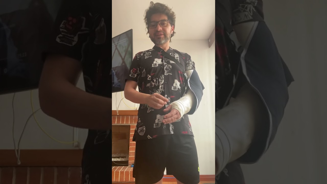 tiempo de baja por operacion de nervio cubital