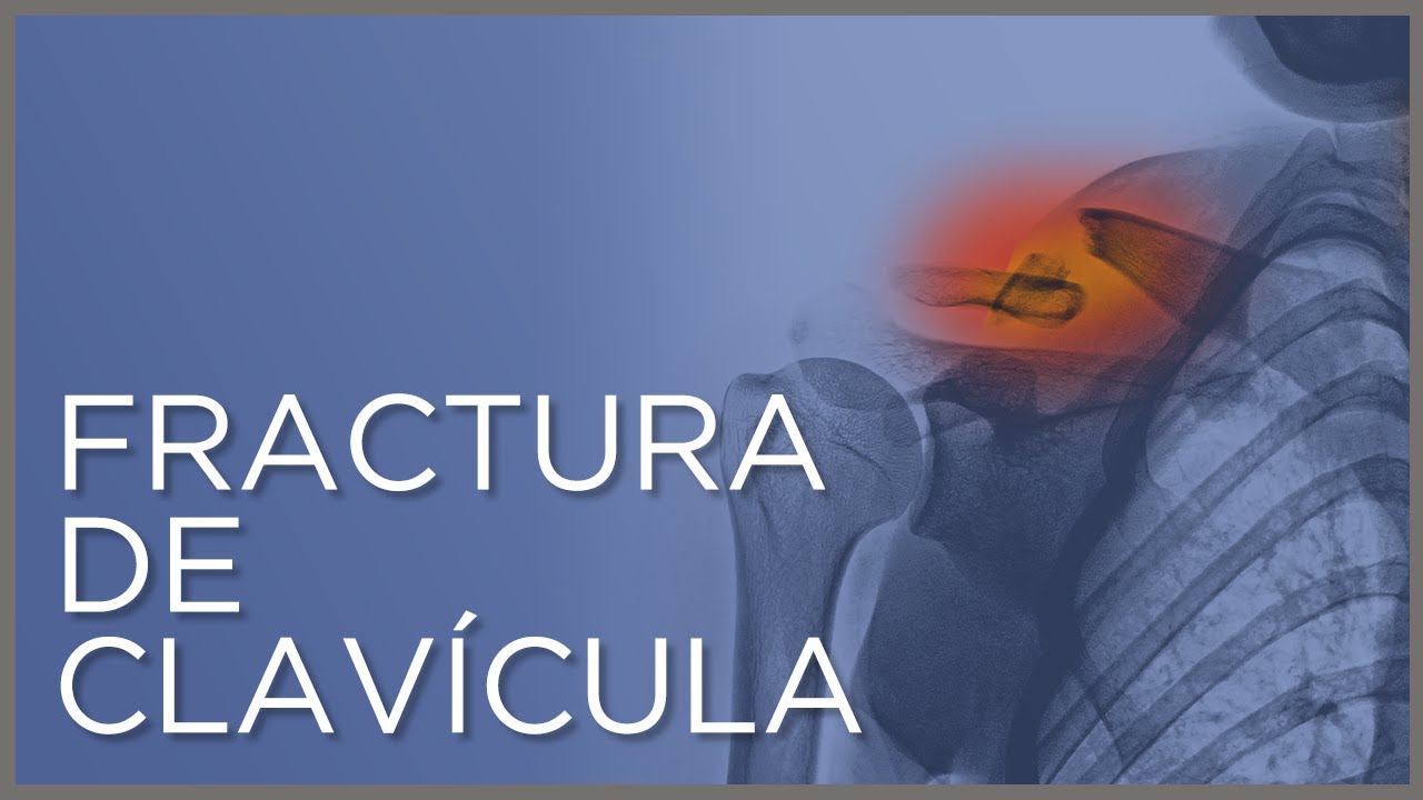 tipo de hueso de la clavicula