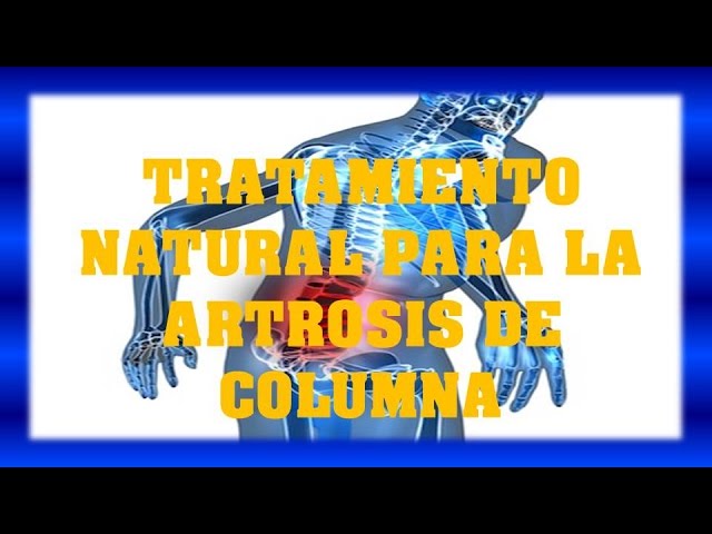 artrosis en la columna tratamiento natural