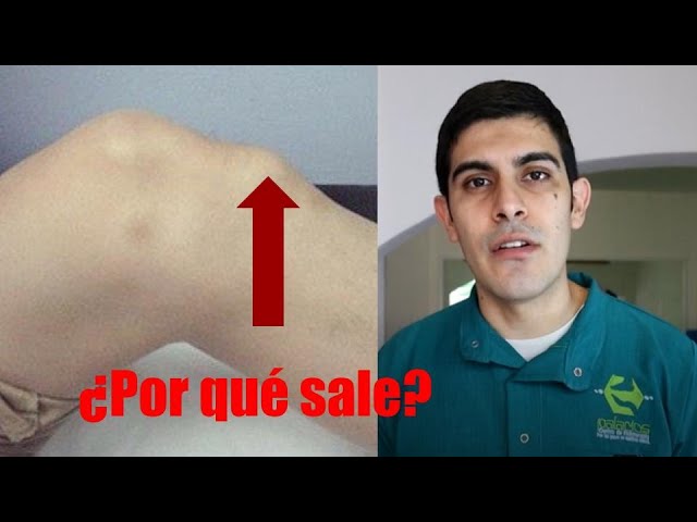 bulto duro en la parte delantera de la rodilla