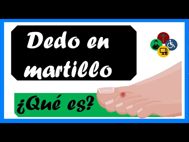 bulto en el dedo del pie