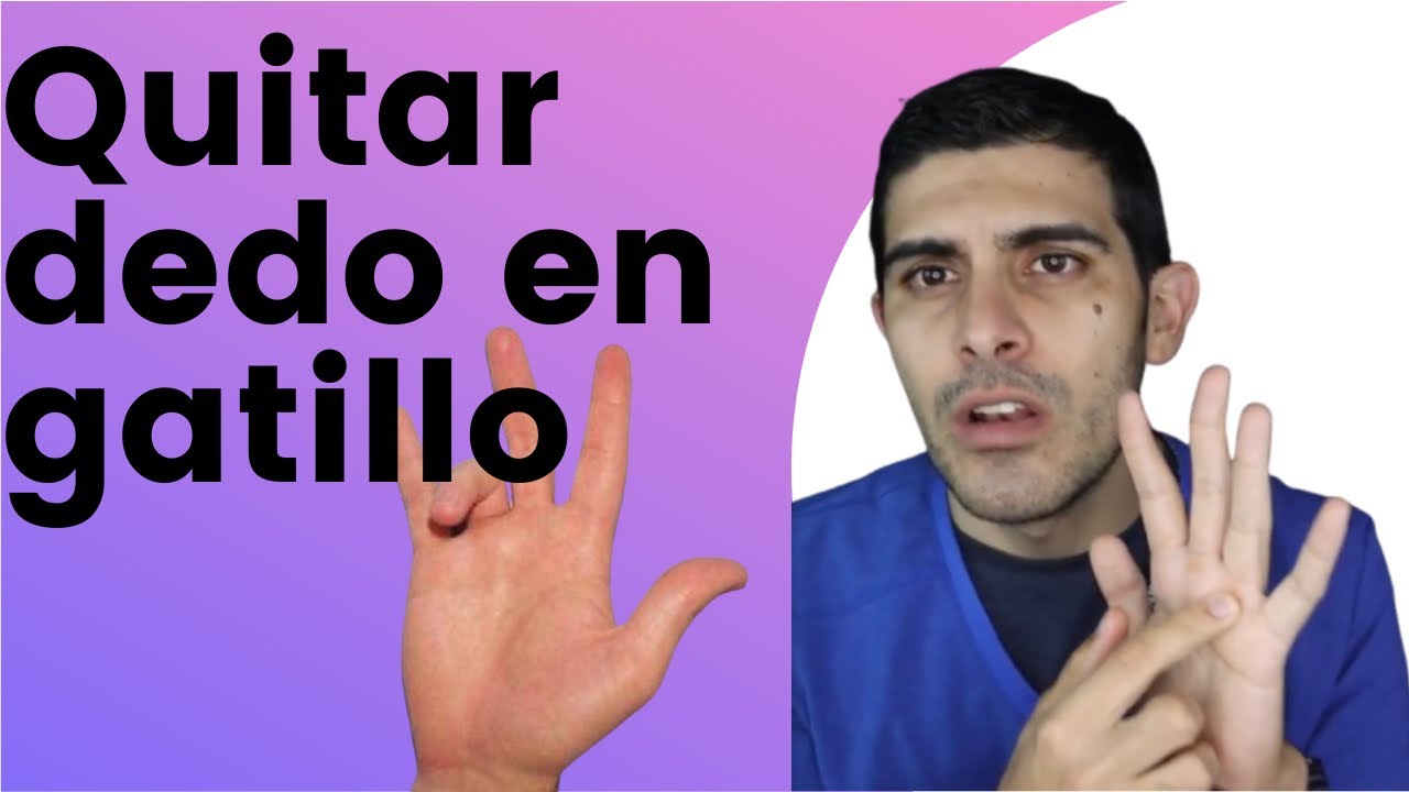 como curar dedo en gatillo sin cirugia