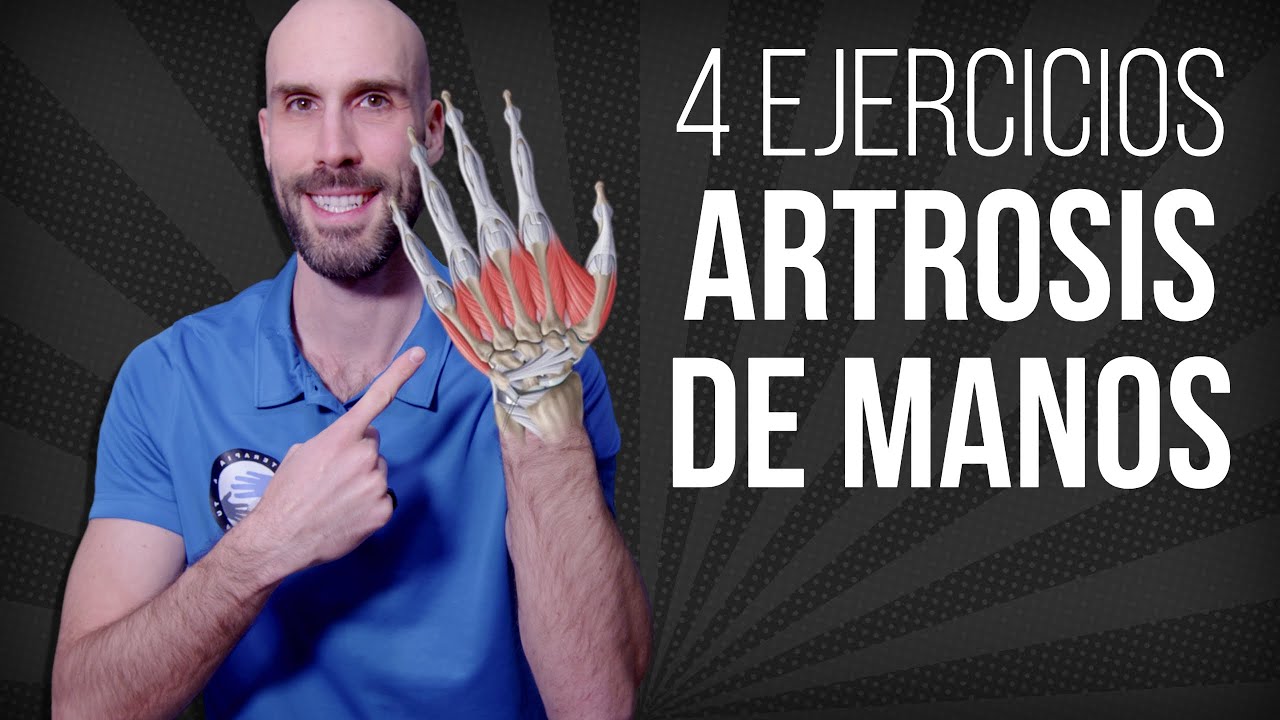 como mejorar la artrosis en los dedos de las manos
