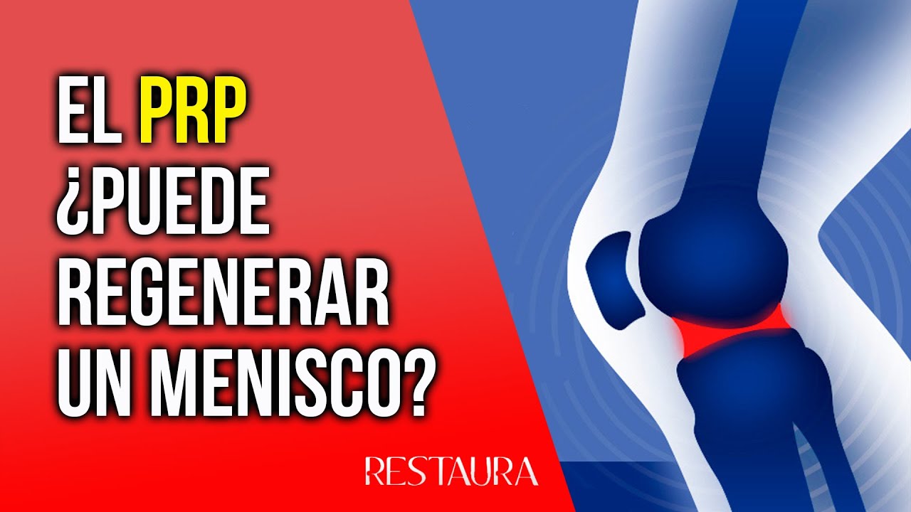 como regenerar los meniscos de la rodilla