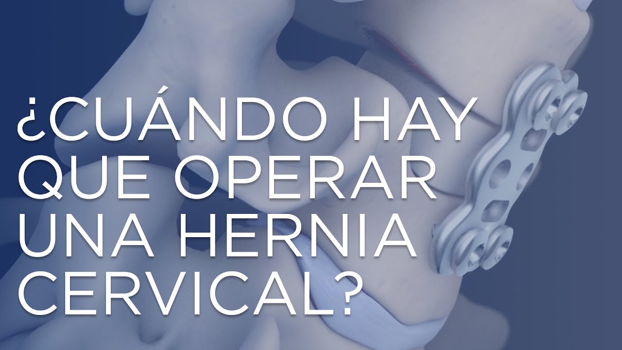 como se opera una hernia cervical