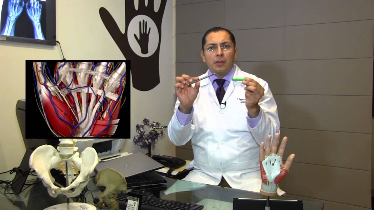 como son los tendones de la mano