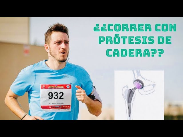 con protesis de cadera se puede correr