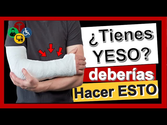 cuanto pesa un yeso en el brazo