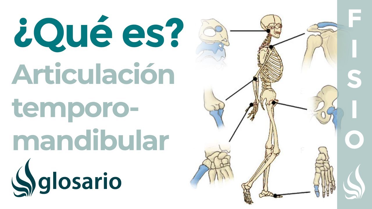 disfunción de la articulación temporomandibular atm