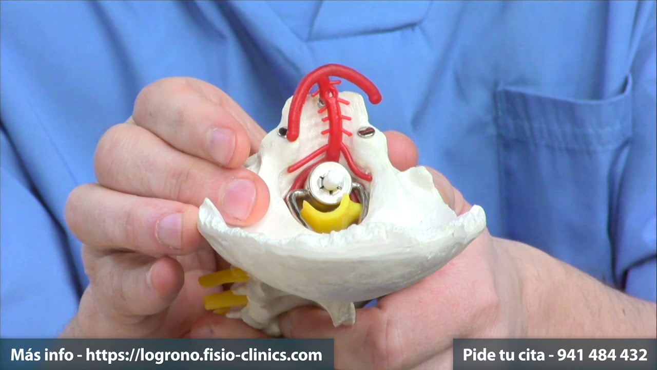 dolor cervical y mareos que tomar