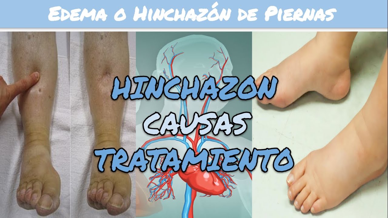 enfermedades de los pies en adultos mayores