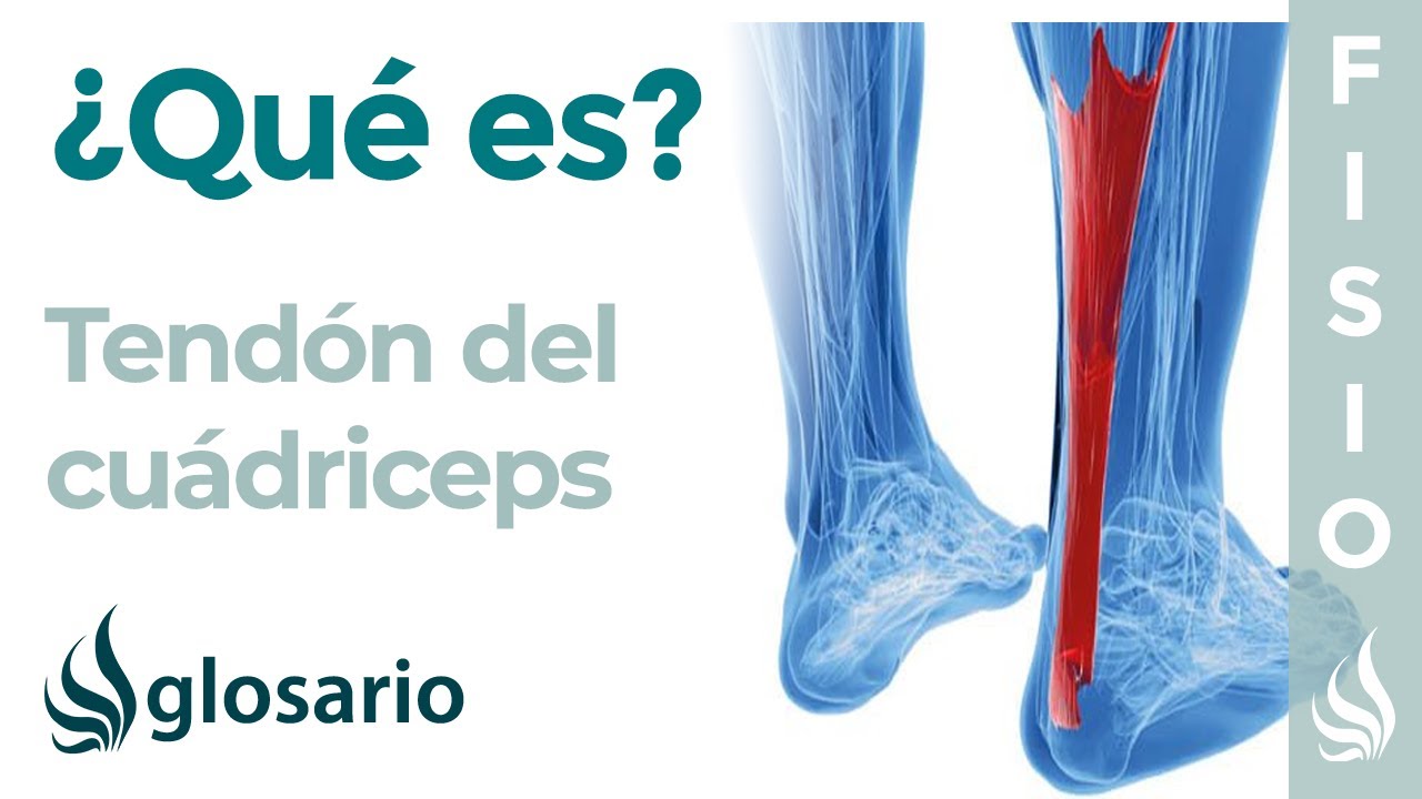 entesopatia calcica del tendon del cuadriceps