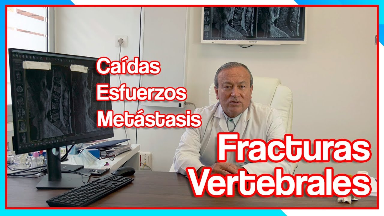 fractura de columna vertebral por caida