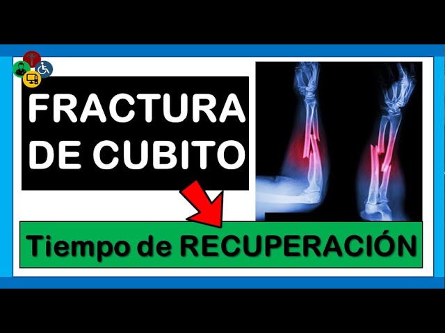fractura de cubito y radio tiempo de recuperacion
