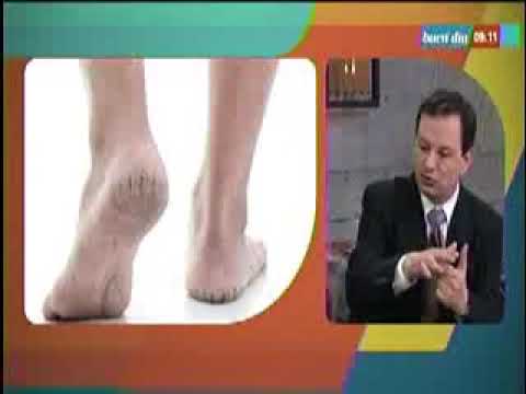 grietas en los talones con sangre