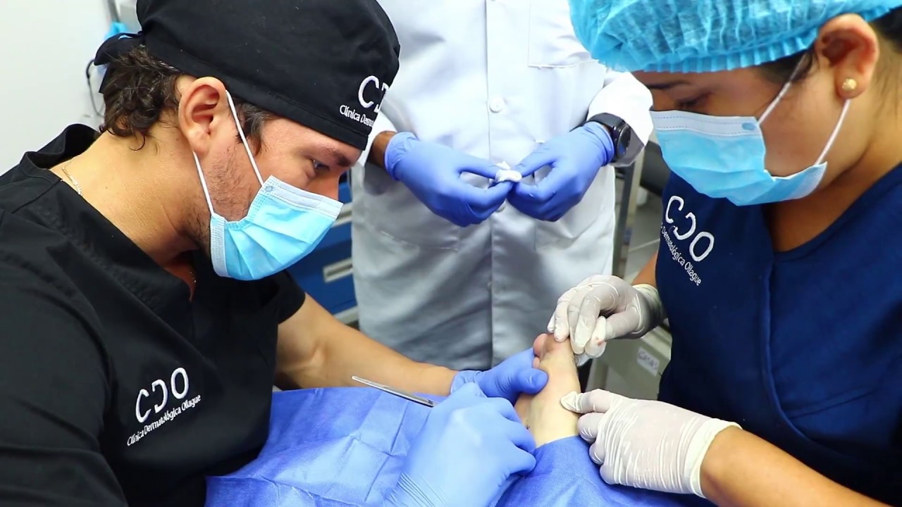 hematoma en la planta del pie