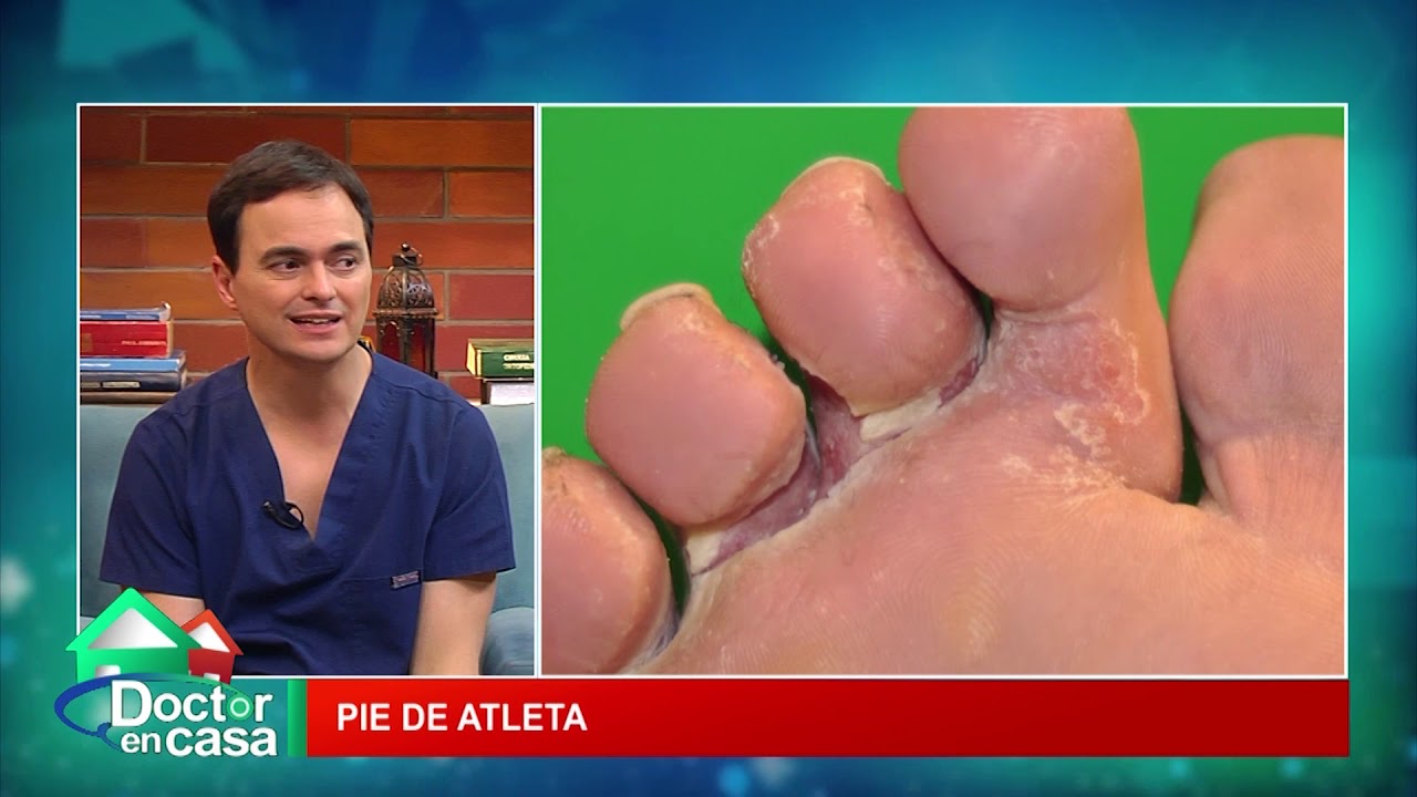 heridas entre los dedos del pie