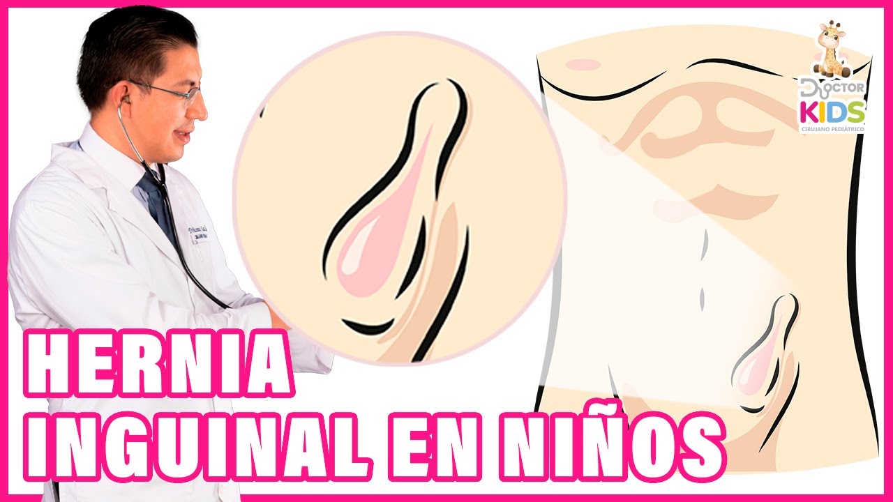 hernia en la ingle en bebes