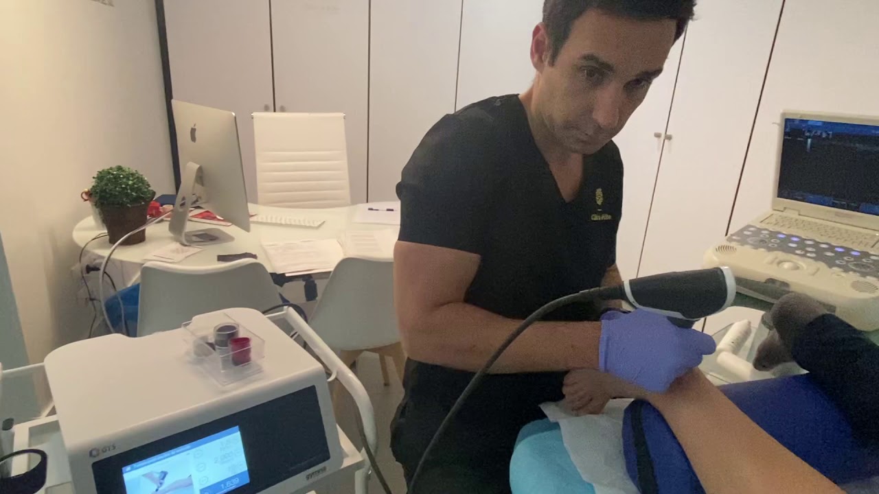insercion del tendon de aquiles en el calcaneo
