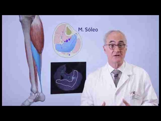 lesion muscular en el soleo tiempo de recuperacion