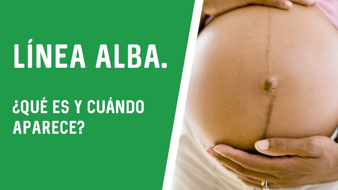 linea alba en mujeres no embarazadas