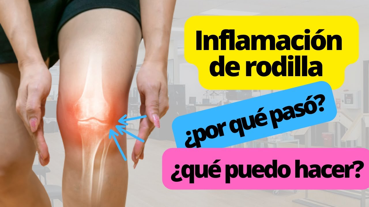 por que se me hinchan las rodillas