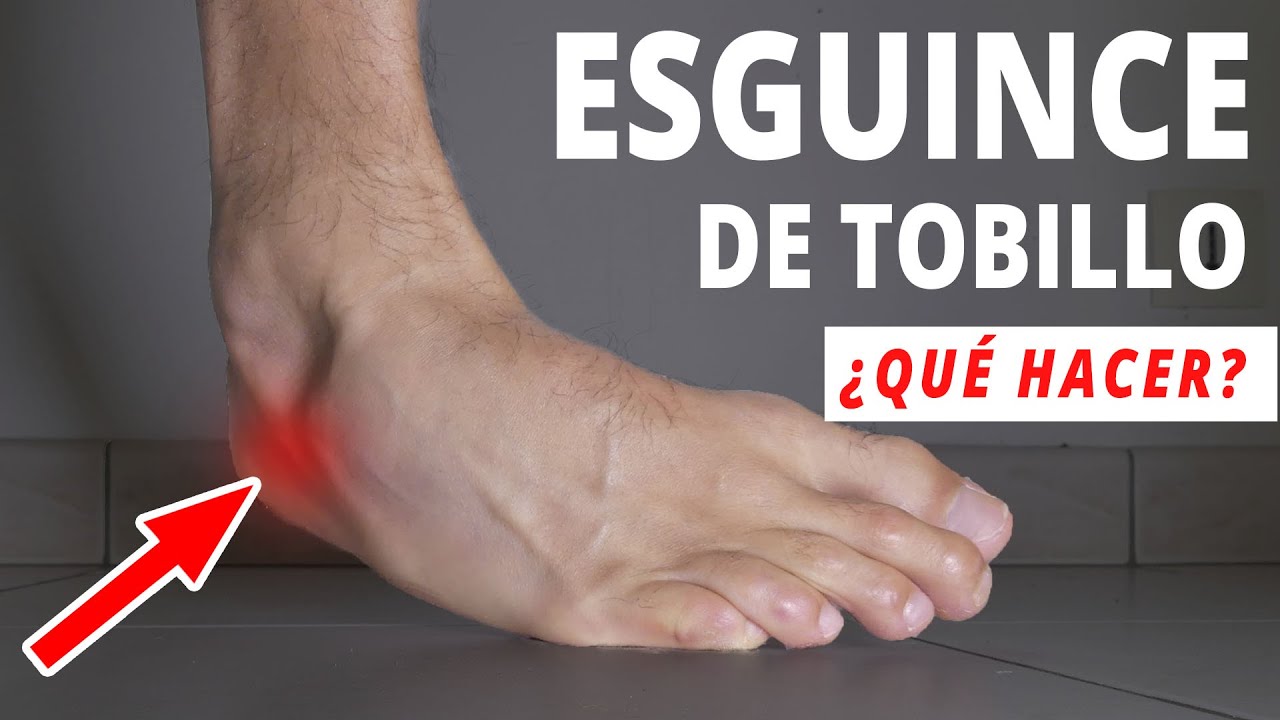 puedo ir a trabajar con un esguince