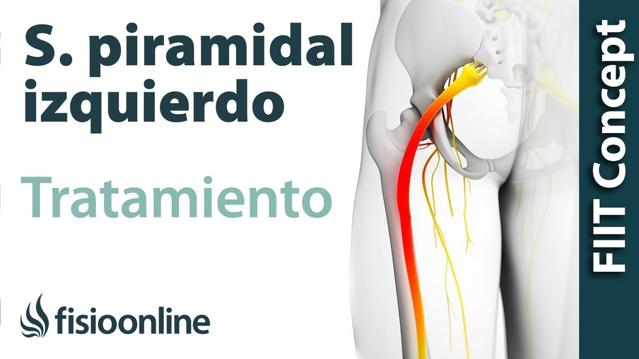 que es el sindrome piramidal izquierdo