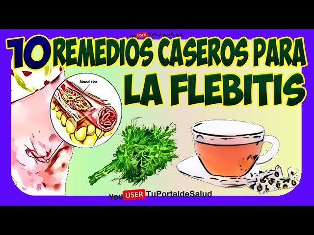remedios caseros para curar la flebitis