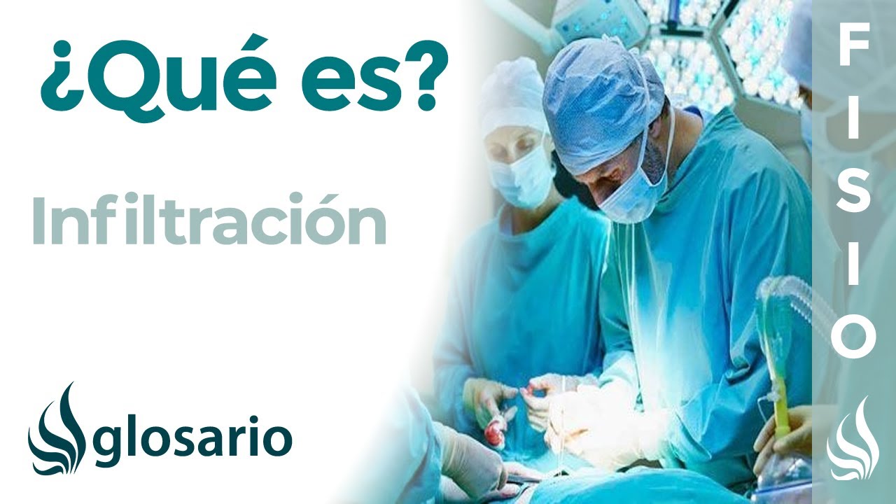se puede caminar después de una infiltración