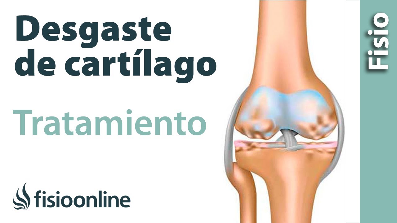 tratamiento para el desgaste del cartilago de la rodilla