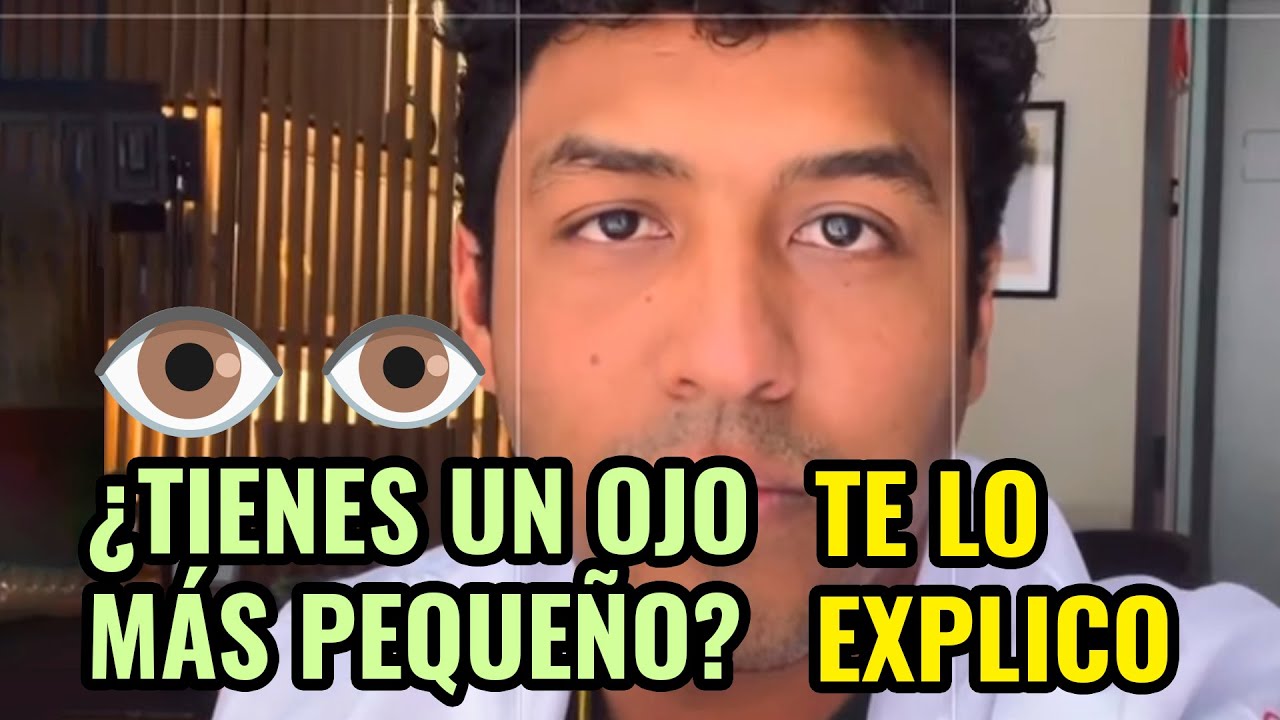 un ojo más cerrado que el otro
